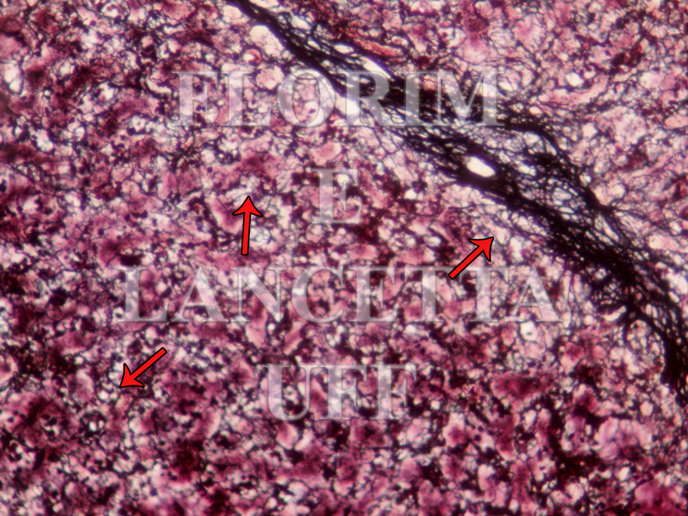 Tecido Conjuntivo Atlas Virtual De Histologia